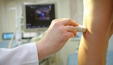 Tratamento a laser de varizes